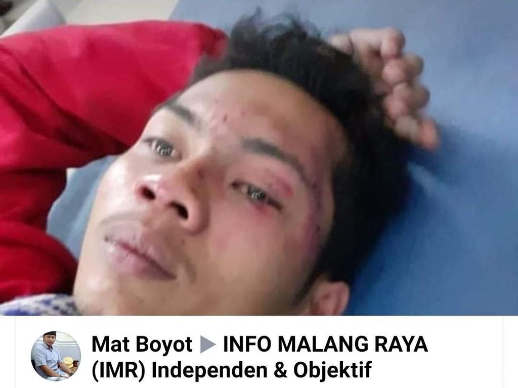 Copet Merajalela di Stadion Kanjuruhan, Ini Langkah Panpel Arema Copet Merajalela di Stadion Kanjuruhan, Ini Langkah Panpel Arema