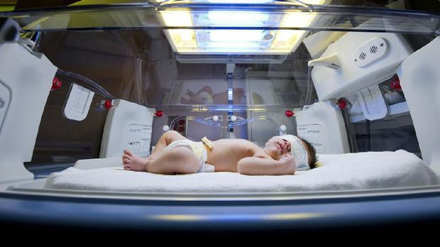 Newborn child baby having a treatment for jaundice under ultraviolet light in incubator. A neonatal intensive care unit (NICU), intensive care nursery (ICN) for premature newborn infants