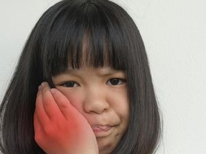 Gejala Gondongan yang Harus Diketahui, Berikut Cara Mencegahnya Gejala Gondongan yang Harus Diketahui, Berikut Cara Mencegahnya