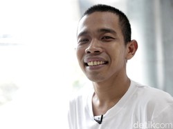 Dede Sunandar Berjuang demi Anak yang Idap Sindrom Williams
