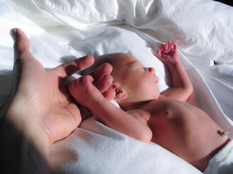 Benarkah Menjemur Bayi Bantu Turunkan Kadar Bilirubin?