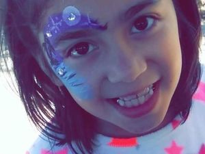 Tragis! Bocah di AS Tewas Usai Diserang 3 Ekor Anjing Pitbull