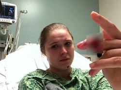 Ngilu... Kecelakaan Syuting, Jari Ronda Rousey Nyaris Putus!