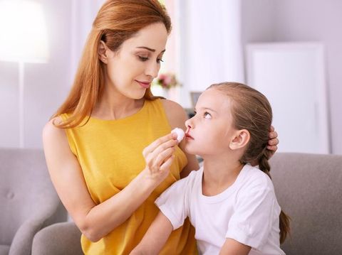 10 Tanda Anak Mimisan Harus Segera Dibawa ke Dokter