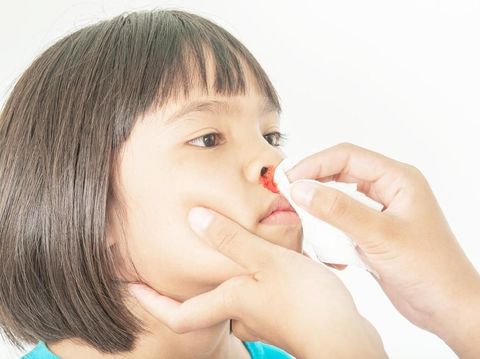 10 Tanda Anak Mimisan Harus Segera Dibawa ke Dokter