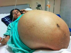 Foto Wanita Ini Viral, Benarkah Sedang Hamil 11 Anak Sekaligus?