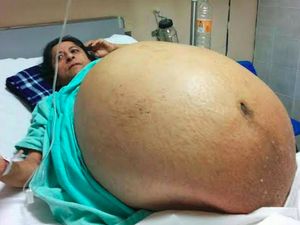 Foto Wanita Ini Viral, Benarkah Sedang Hamil 11 Anak Sekaligus? Foto Wanita Ini Viral, Benarkah Sedang Hamil 11 Anak Sekaligus?