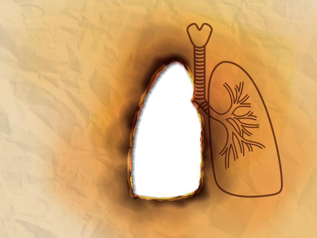 Deretan Penyumbang Tekornya BPJS Kesehatan, Penyakit Terkait Rokok Mendominasi Deretan Penyumbang Tekornya BPJS Kesehatan, Penyakit Terkait Rokok Mendominasi
