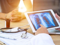 Dikaitkan dengan Paru Kolaps Usai Nge-vape, Apa Itu Chemical Pneumonia?