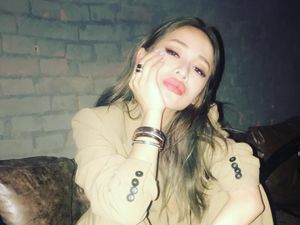 Kisah Elva Hsiao, Digigit Anjing dan Rasakan seperti Terbakar Besi Kisah Elva Hsiao, Digigit Anjing dan Rasakan seperti Terbakar Besi