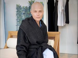 Penampakan Selma Blair yang Jadi Botak Karena Penyakit Multiple Sclerosis