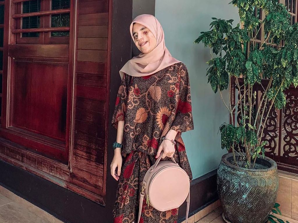 Mahasiswi yang Separuh Wajahnya Rusak Ini Viral, Tampil PD Foto #OOTD Mahasiswi yang Separuh Wajahnya Rusak Ini Viral, Tampil PD Foto #OOTD