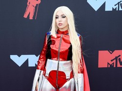 Setahun Mengalami Gejala COVID-19, Rambut Penyanyi Ini Rontok Parah