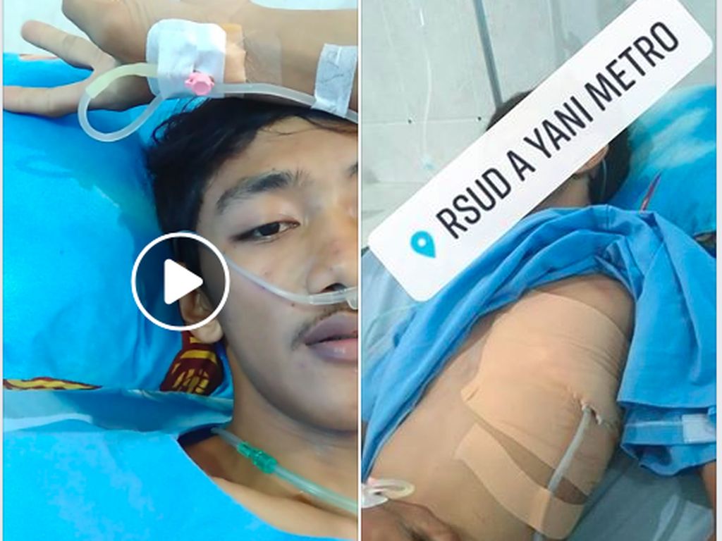 Viral Kisah Pemuda Paru-parunya Kolaps, Kapok Isap Rokok Viral Kisah Pemuda Paru-parunya Kolaps, Kapok Isap Rokok