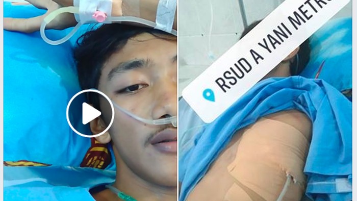 Mantan perokok ini nyaris kehilangan sebelah paru-parunya (Foto: Facebook/Nikoannd) Mantan perokok ini nyaris kehilangan sebelah paru-parunya (Foto: Facebook/Nikoannd)