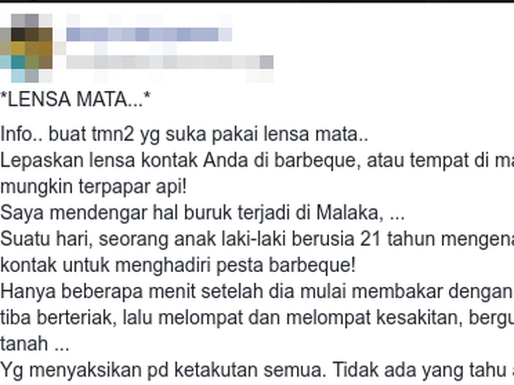 Benarkah Kabar Viral Lensa Kontak Bisa Meleleh Dekat Api? Benarkah Kabar Viral Lensa Kontak Bisa Meleleh Dekat Api?