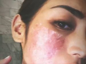 Alami Alergi Anestesi, Jessica Iskandar Banyak Dirugikan Alami Alergi Anestesi, Jessica Iskandar Banyak Dirugikan