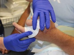 Ditanam di Selangkangan, Tangan Pria yang Putus Berhasil Disambung Kembali