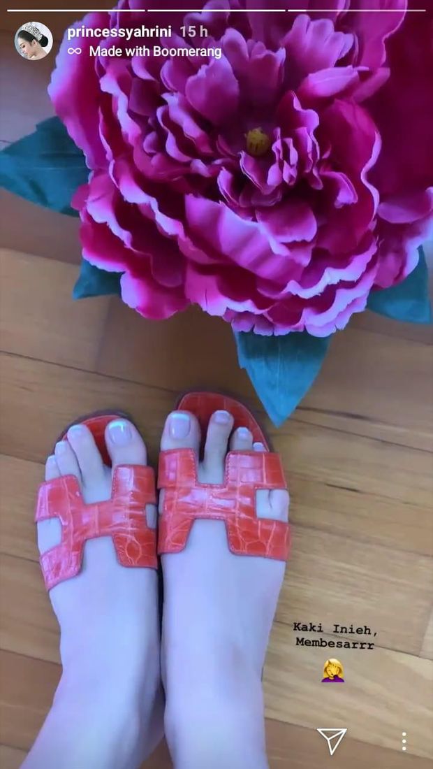 Kaki Syahrini terlihat bengkak