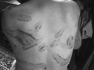 Kisah Warga Kashmir yang Mengklaim Disiksa Tentara