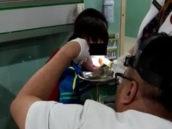 Kisah Viral Lintah di Hidung Bocah Solo, Berawal dari Renang