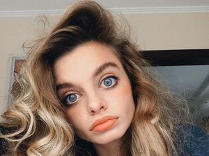 Asli atau Palsu? Mata Besar Model Cantik Ini Jadi Perdebatan