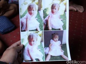 Bukan Hanya Mata, Rambut Bocah Amel Bisa Berubah Warna Bukan Hanya Mata, Rambut Bocah Amel Bisa Berubah Warna