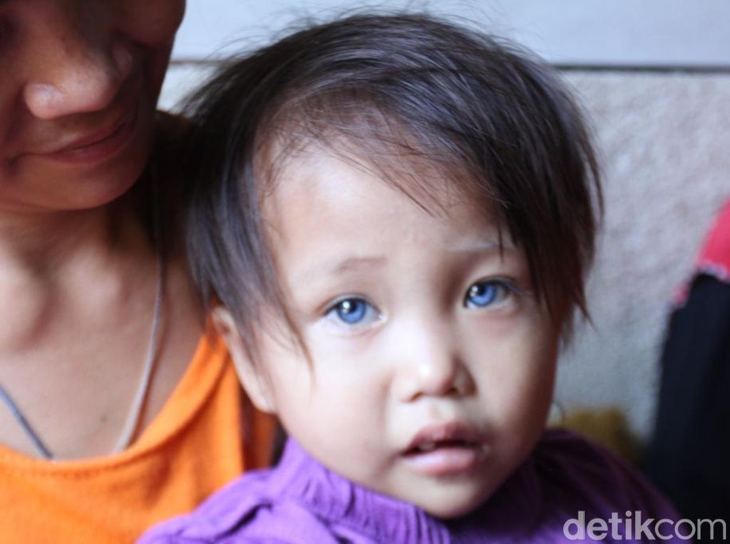 Mata Anak di Bandung Bisa Berubah Warna, Aceh hingga Buton Punya Ras Mata Biru Mata Anak di Bandung Bisa Berubah Warna, Aceh hingga Buton Punya Ras Mata Biru