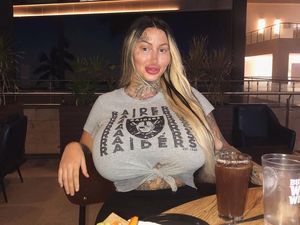 Penampilan Wanita yang Kecanduan Operasi Plastik Habiskan Rp 1,4 Miliar