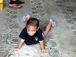 Harapan Ortu di Cianjur yang Anaknya Berkelamin Ganda