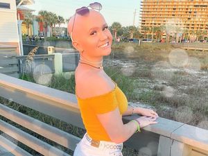 Lucu, Video Ini Ungkap Keuntungan Berkencan dengan Wanita Botak