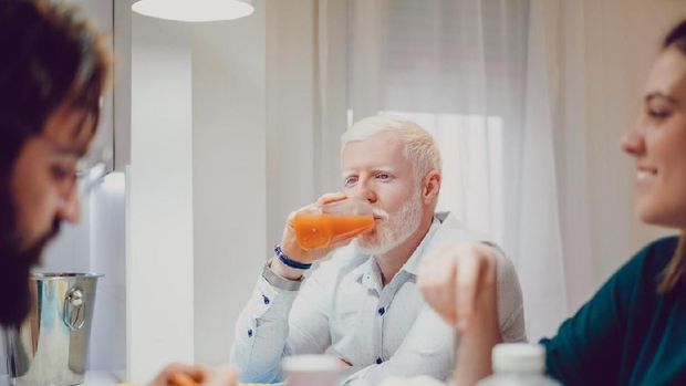 ilustrasi albino