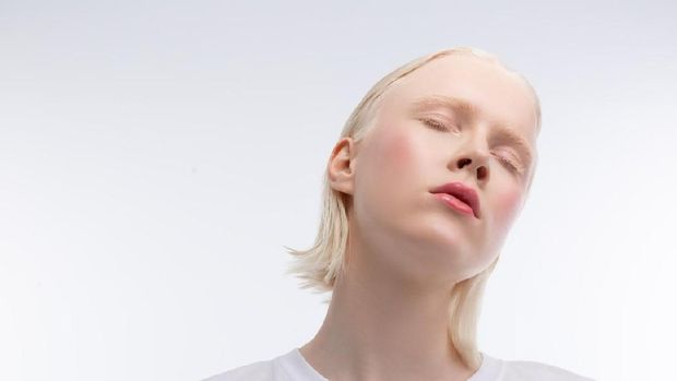 ilustrasi albino