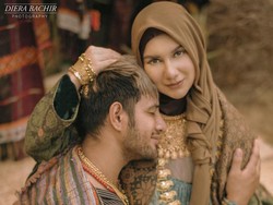 Terlalu Capai, Irish Bella Sempat Alami Pendarahan