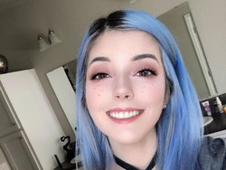 Transformasi Wanita yang Dulu Jerawatan Kini Mulus Ini Diragukan Netizen