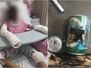 Iseng Bikin Popcorn Pakai Kaleng Soda, Remaja Ini Tewas Terbakar Iseng Bikin Popcorn Pakai Kaleng Soda, Remaja Ini Tewas Terbakar