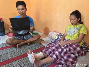 Siswi SMP Ini Didorong Temannya dari Tangga Hingga Tak Bisa Sekolah