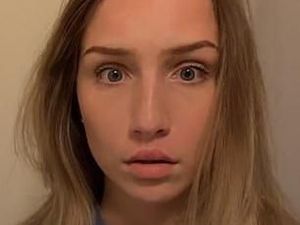 Viral Tren Tempel Bibir Pakai Lem Demi Tampil Seksi Seperti Kylie Jenner