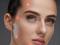 Pico Derma, Laser untuk Wajah yang Diklaim Minim Rasa Sakit