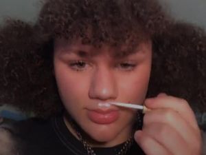 Pakar Kesehatan Ungkap Bahaya Tren Viral Tempelkan Bibir Pakai Lem