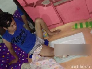 Kasihan, Kaki Warga Pasuruan Ini Membusuk karena Tak Mampu Berobat