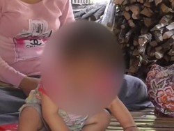 Prihatin! Ortu Tak Mampu Beli Susu, Bayi 14 Bulan Diberi Kopi