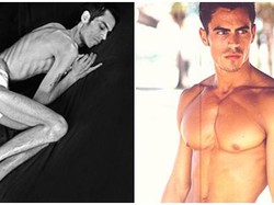 Tinggal Tulang dan Kulit, 5 Kasus Gangguan Makan Anoreksia Ini Bikin Ngeri