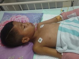 Ahmad Dani Jalani Perawatan di Surabaya Karena Alami Luka Bakar Ahmad Dani Jalani Perawatan di Surabaya Karena Alami Luka Bakar