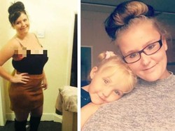 Sedih, Wanita Ini Dadanya Terus Membesar Sampai Cup L, Hingga Susah Jalan