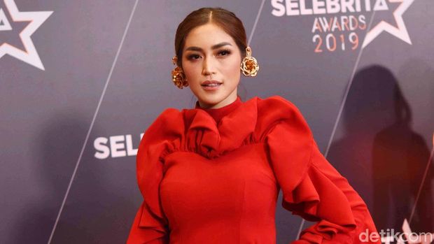 5 Artis Indonesia Gagal Cantik karena Perawatan: Muka Bengkak-Bruntusan
