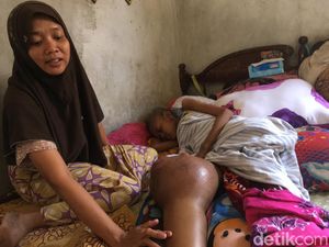 Tolong, Siswi SMP Mojokerto Butuh Bantuan Karena Sakit Kanker Tulang