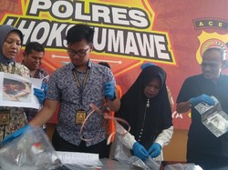 Bocah Dipaksa Ngemis di Aceh Trauma, Sekujur Tubuhnya Penuh Luka