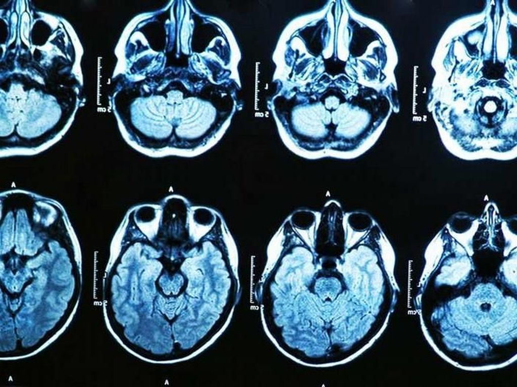 Dikira Serangan Rahasia, Penyakit Misterius di Kuba Disebabkan Pestisida Dikira Serangan Rahasia, Penyakit Misterius di Kuba Disebabkan Pestisida