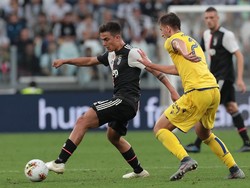 Karena Juventus Memang Sedang dalam Renovasi